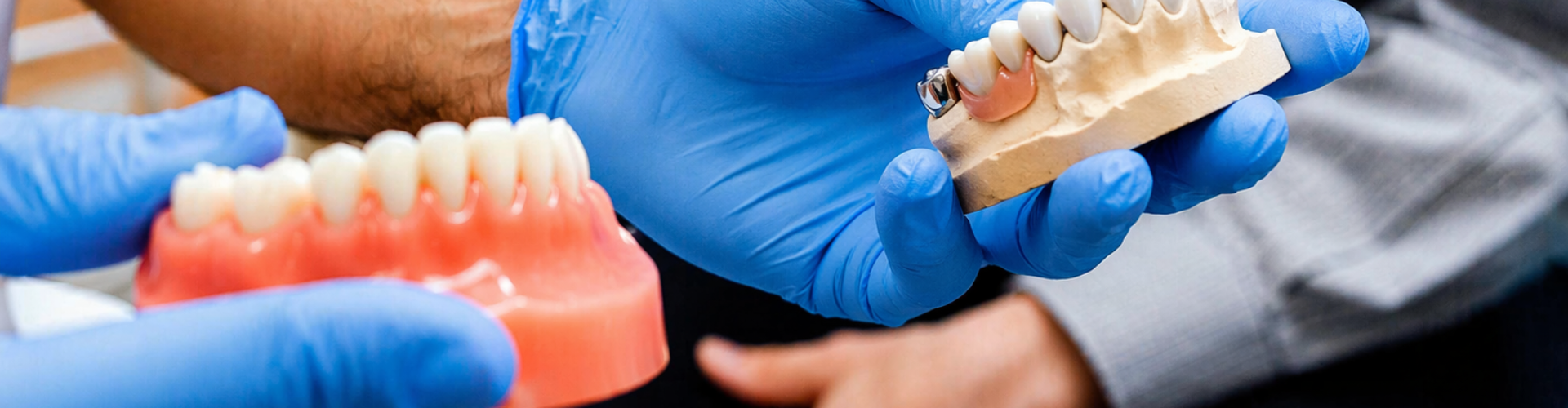 Gloved hands holding plaster mold with dental bridge on teeth and model of denture.